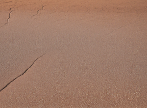 Редкое заболевание: Беременная из Малайзии резко постарела за одну ночь