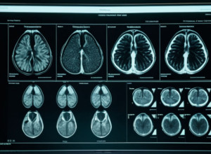 Здоровье Трампа под контролем: Официальные результаты МРТ брюшной полости