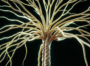 Аника Шрайбер: Жизнь с рассеянным склерозом и вдохновение для миллионов