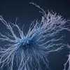 Рассеянный склероз: когда иммунитет атакует нервы. Объясняет эксперт