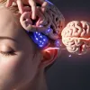 Уброгепант: Новое исследование показало, что препарат от мигрени эффективен против ранних симптомов
