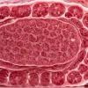 REWE отзывает опасную салями: бактерии E. coli могут вызвать отказ почек