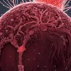 Сепсис: Смертельная угроза, опаснее инфаркта – каждый пятый летальный исход в мире связан с заражением крови