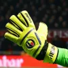 Мануэль Нойер играет в специальной перчатке с четырьмя пальцами: Причина необычного снаряжения вратаря "Баварии"